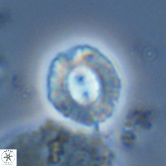 Coccolithus sarsiae VR 05696