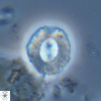 Coccolithus sarsiae VR 05697