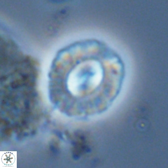 Coccolithus sarsiae VR 05698
