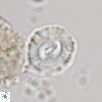 Coccolithus sarsiae VR 05693