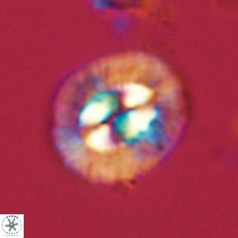 Coccolithus sarsiae VR 03684