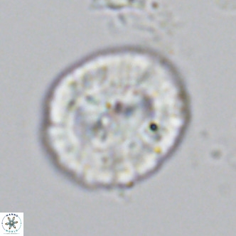 Coccolithus sarsiae VR 03685