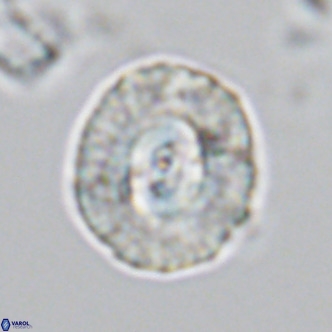 Coccolithus sarsiae VR 03686