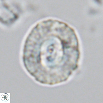 Coccolithus sarsiae VR 03686