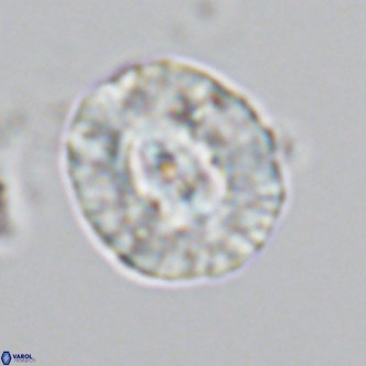 Coccolithus sarsiae VR 03687