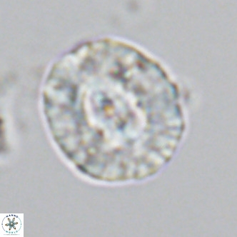 Coccolithus sarsiae VR 03687