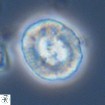 Coccolithus sarsiae VR 03689