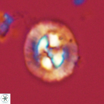 Coccolithus sarsiae VR 03680