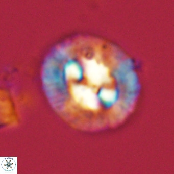 Coccolithus sarsiae VR 03681