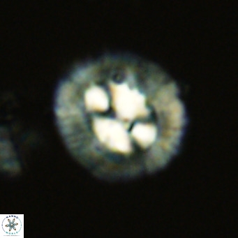 Coccolithus sarsiae VR 03682