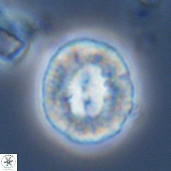 Coccolithus sarsiae VR 03690