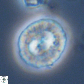 Coccolithus sarsiae VR 03691