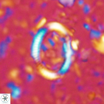 Coccolithus streckeri VR 16465