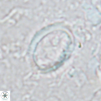 Coccolithus streckeri VR 16470