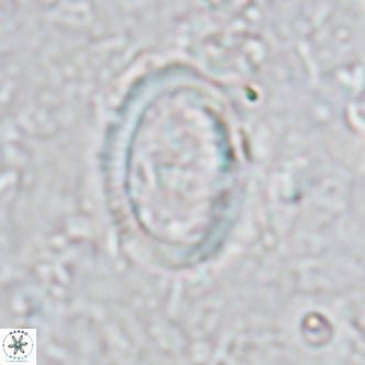 Coccolithus streckeri VR 16472