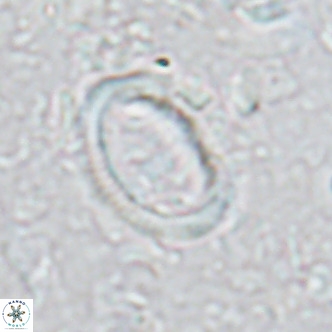 Coccolithus streckeri VR 16473