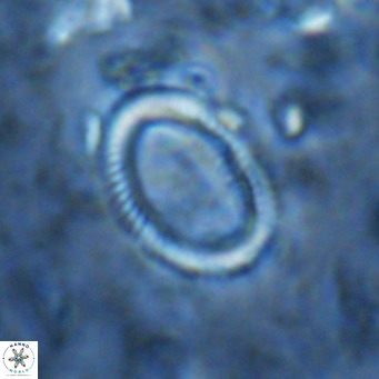 Coccolithus streckeri VR 16475