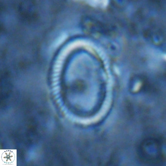 Coccolithus streckeri VR 16476