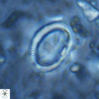 Coccolithus streckeri VR 16478