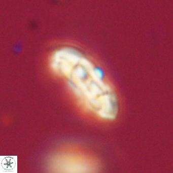 Coccolithus supremus 68342