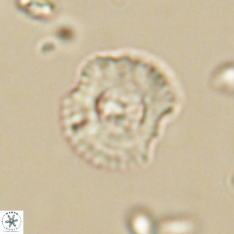 Coccolithus supremus 68363