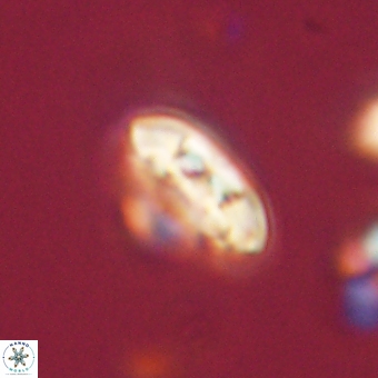 Coccolithus supremus 68320