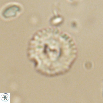 Coccolithus supremus 68330