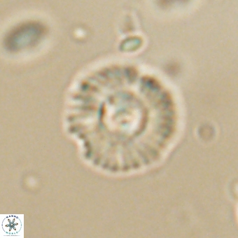 Coccolithus supremus 68331