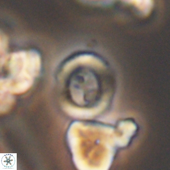 Coptolithus baticlypeatus 8848