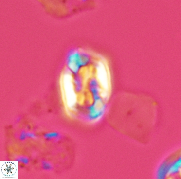 Corollithion completum 3374