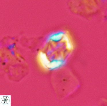 Corollithion completum 3375