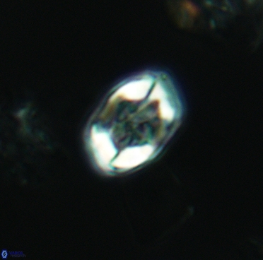 Corollithion completum 3376