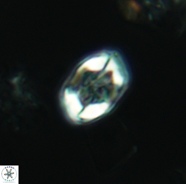 Corollithion completum 3376