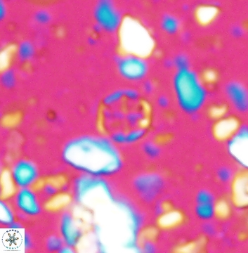 Corollithion baldiae 7517