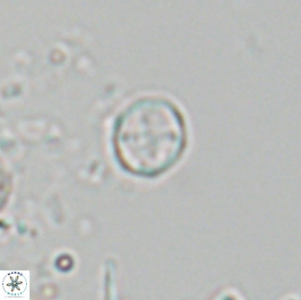 Corollithion baldiae 18593
