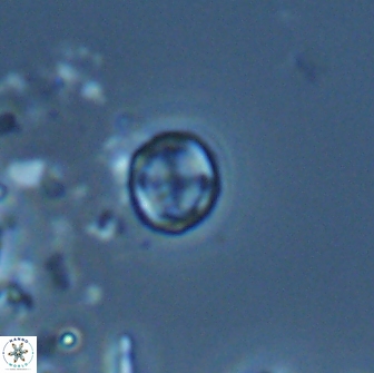 Corollithion baldiae 18594
