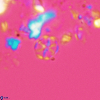 Corollithion exiguum 762