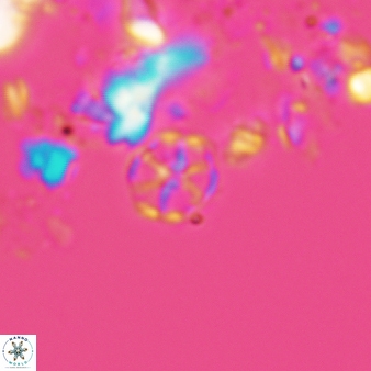Corollithion exiguum 762