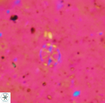 Corollithion exiguum 1111