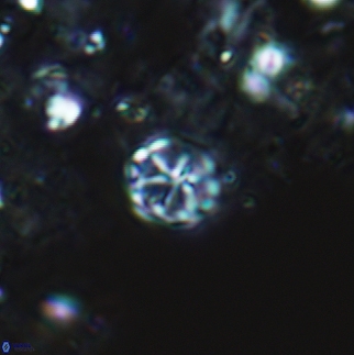 Corollithion exiguum 12