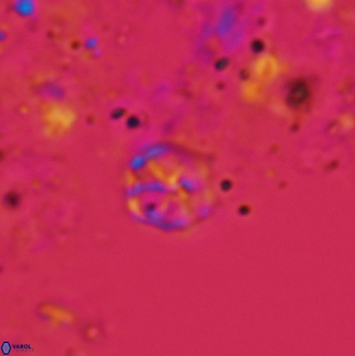 Corollithion exiguum 13