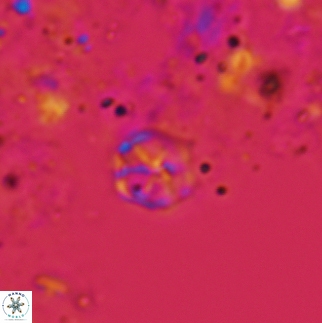 Corollithion exiguum 13