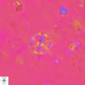 Corollithion exiguum 1497