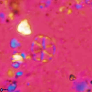 Corollithion exiguum 25