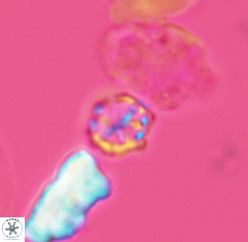 Corollithion exiguum 3217