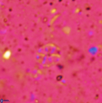 Corollithion exiguum 1189