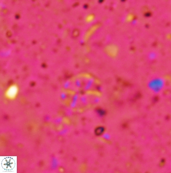 Corollithion exiguum 1189