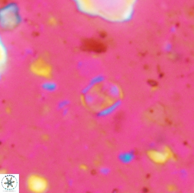 Corollithion karegae 4418