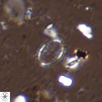 Corollithion msakyae 36147