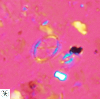 Corollithion msakyae 36148
